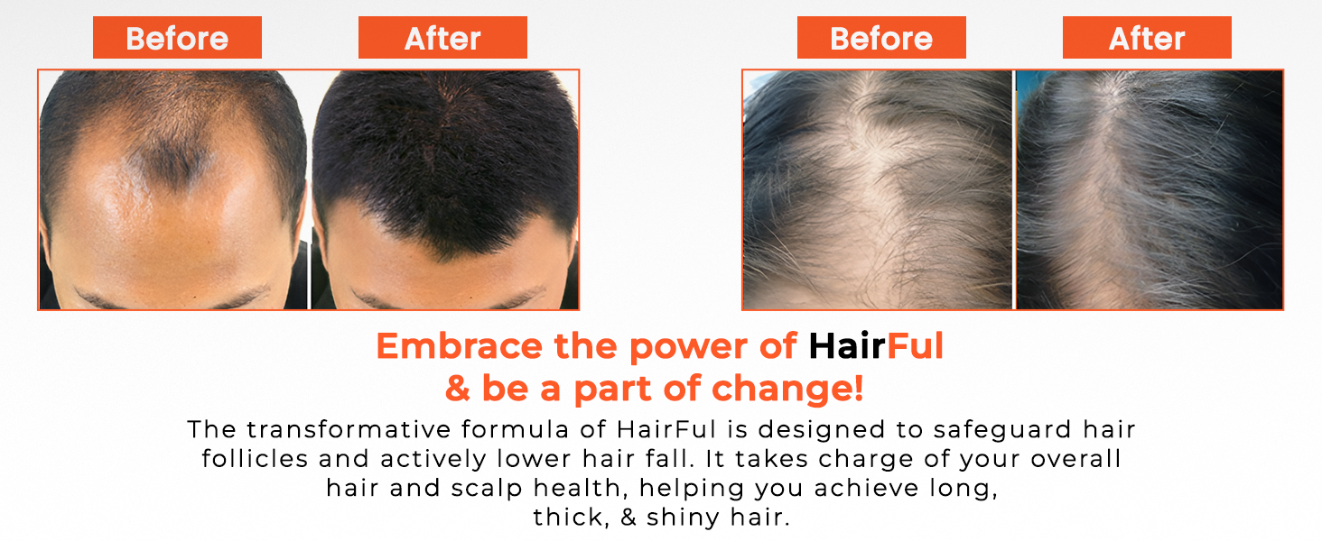 HairFul Biotin Supplement Tablet | for Help Hair Growth, Strong Hair and Glowing Skin | Hair Fall Control | Fights Nail Brittleness for Women and Men, Multivitamin Tablet(Pack of 2)30 Biotin Tablets