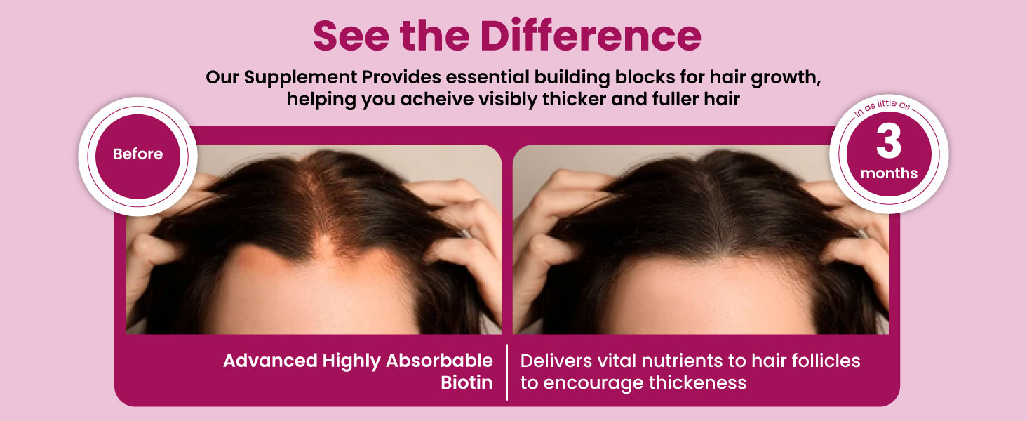 ZEROHARM Biotin Tablets for Hair Growth - Vitamin B7 from Sesbania Grandiflora - Supports Skin Hydration & Nail Strength - For Men & Women - Nano Formulated 120 Veg Tablets