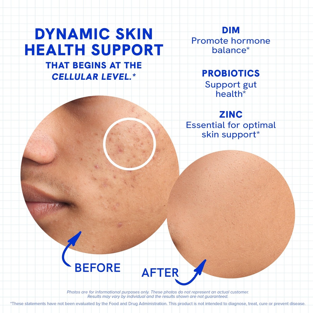 clear-skin-supplement-with-zinc-dim-prob-5.jpg