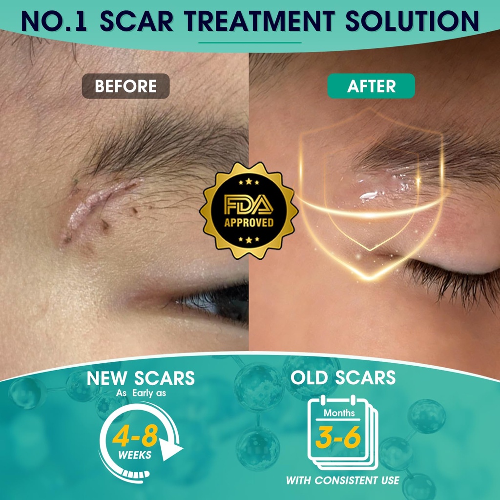 silicone-scar-gel-massage-design-for-fas-4.jpg