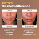 mela-daily-glow-for-healthy-melanin-rich-4.jpg