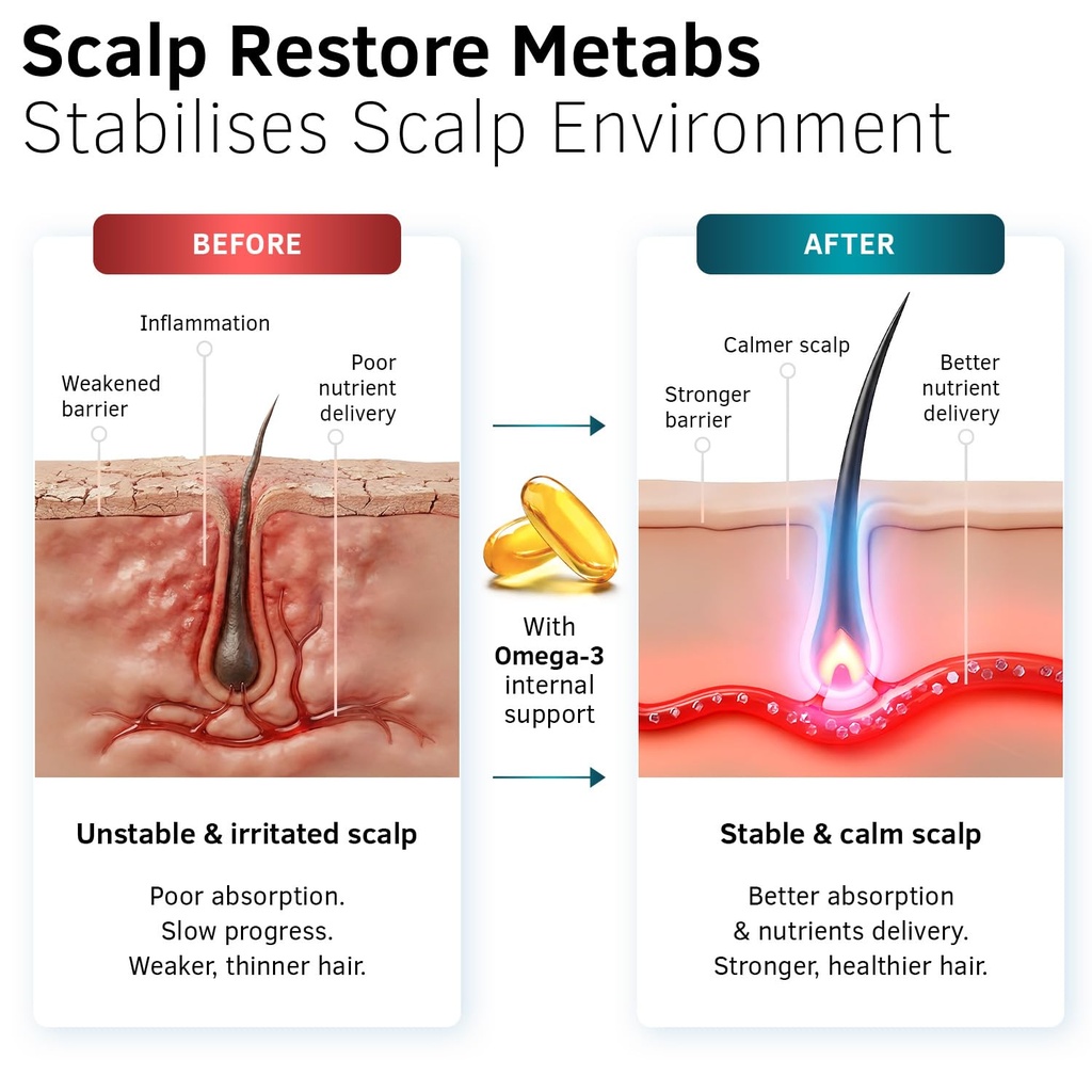 ustraa-scalp-restore-metabs-flax-seed-oi-718VjQ8eMsL.jpg