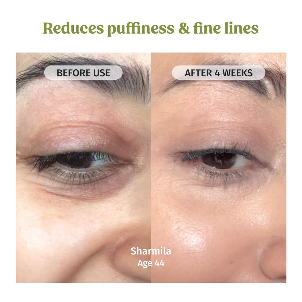 vilvah-under-eye-cream-reduces-dark-circ-61UWx0d7mcL.jpg