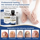 toenail-fungus-treatment-extra-strength--2.jpg