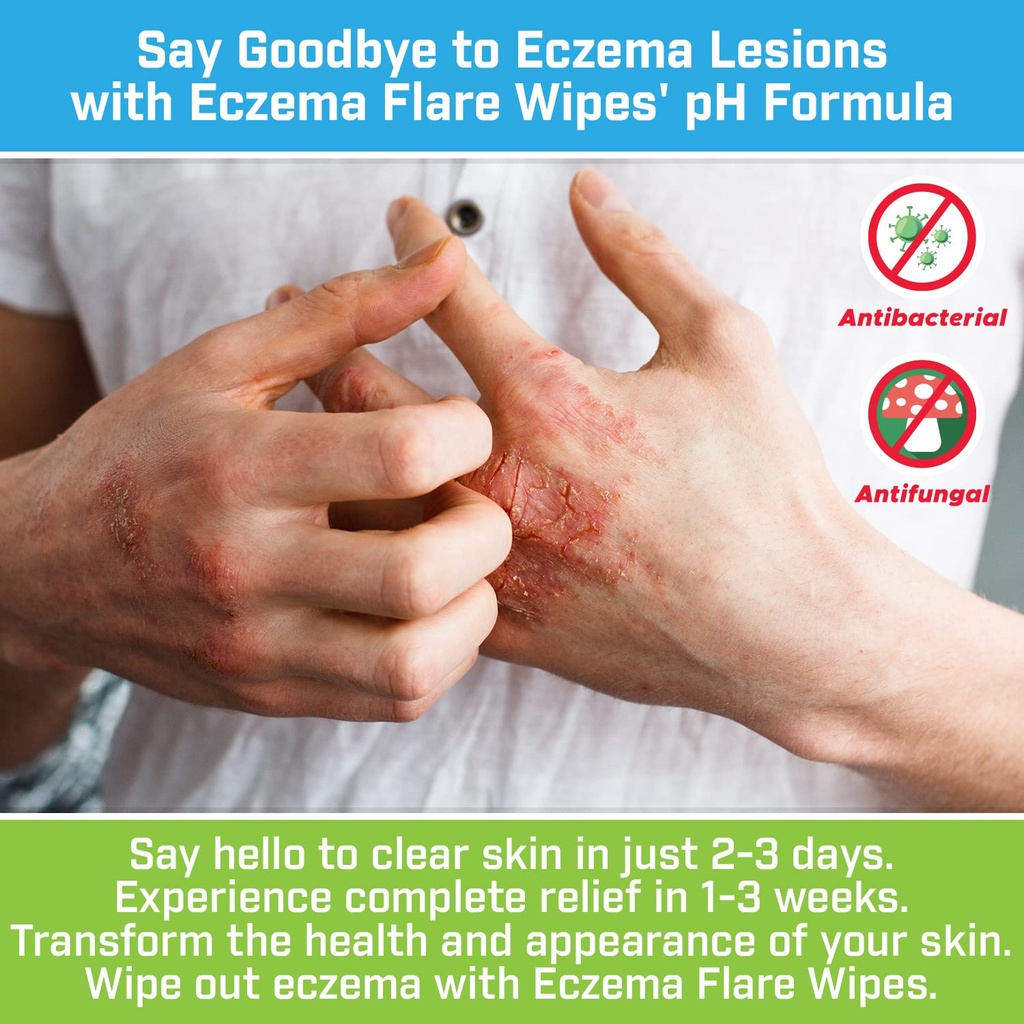 eczema-flare-wipes---all-natural-fast-ac-5.jpg