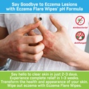 eczema-flare-wipes---all-natural-fast-ac-5.jpg