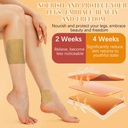 turmeric-varicose-veins-treatment-for-le-3.jpg