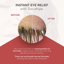zocular---zocuwipe-eyelid-wipes-with-nat-4.jpg