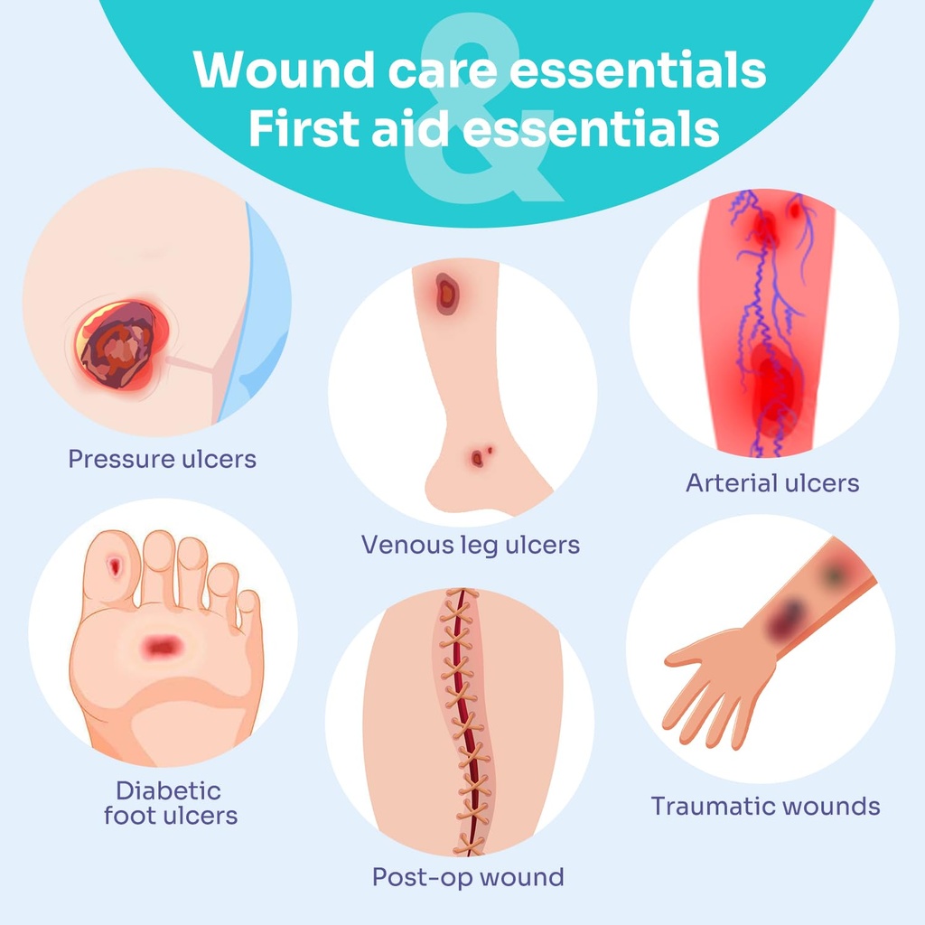 conkote-super-absorbent-dressing-for-wou-6.jpg