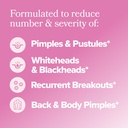 o-positiv-flo-acne-capsules-reduce-numbe-2.jpg