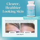clear-skin-vitamins-for-women-men-supple-2.jpg