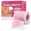 Silikónové zjazvené listy, Silikónové zjazvené pásky pre chirurgické jazvy, C-Section, Tummy Tuck, Keloidné odstránenie zátok, Face Tape pre vrásky prenocovanie (1.6"X 59" Roll-1.5M-Pigment Reduction-Pink)