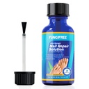 Toenail Fungus Liečba extra sila - nechty huba liečba pre nechty - Toe nechty huba liečba extra sila - nechty huba liečba (30ml)