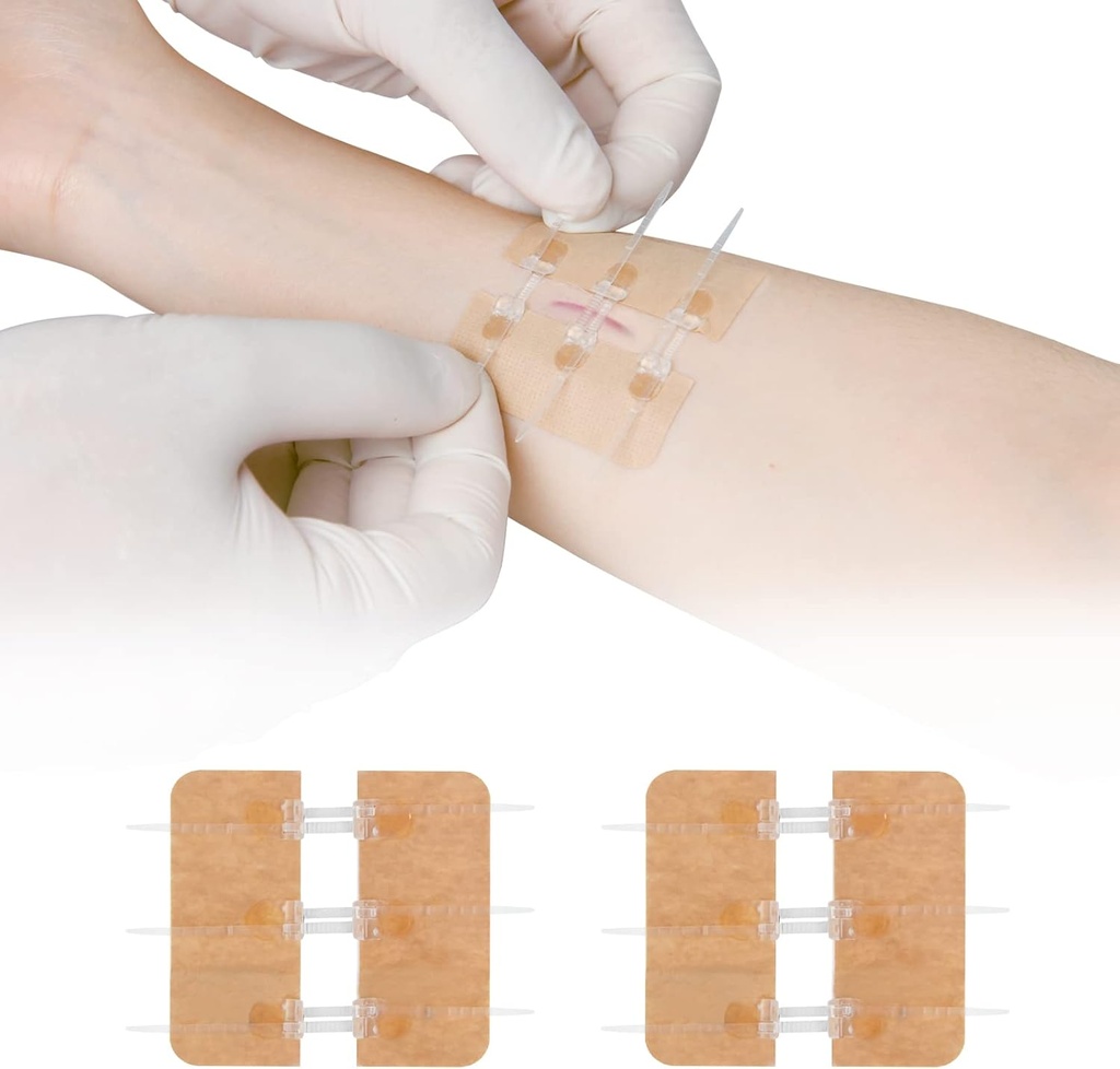Zip Stitch Lacerácia opravy bez stehov Butterfly Bandaids Quick Clot - Núdzové rany uzavretie zariadenia 2 kusy [PU]