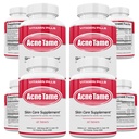 Acnetame Acne Pills Supplement- Clear Skin Vitamins Pill for Oily Skin Treatment, Hormonal Blemishes, Anti Spots & Cystic Acnes Supplements for Women, Men, Teens & Adults- 240 Oral Tablets