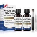 Toenail Fungus Liečba Extra sila s 25% kyseliny unidecylénovej, Vrastajúce nechty ošetrenie, opravy nechtov, Fungus liečba nechtov, žltý necht, poškodené nechty nohy huba liečba extra sila