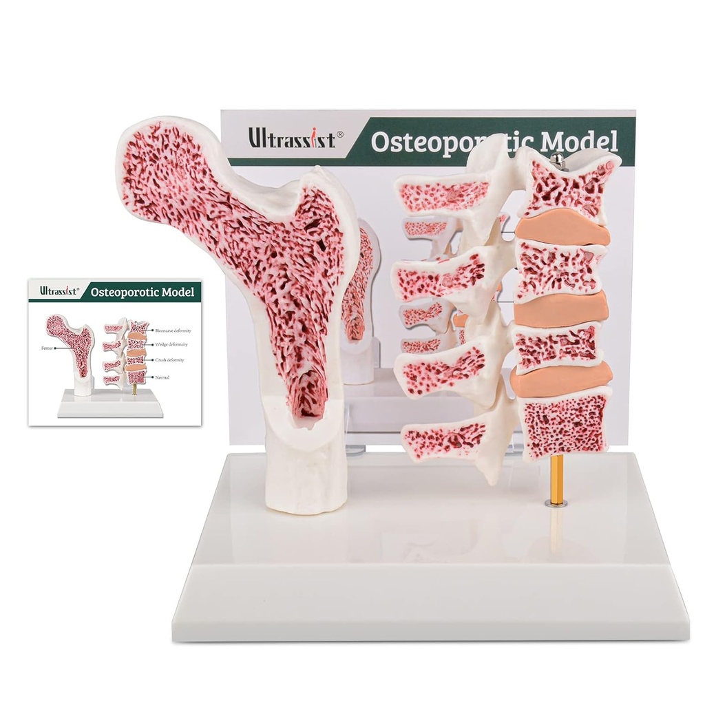 Ultraist Human Anatomy Osteoporóza Model, Vertebrae Anatomical Skeleton Model so študijnou kartou pre lekárske študentské výučby demonštrácie