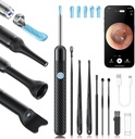 Loyker X6 Ear Wax Tool Camera, Ear Cleaner with Camera, FSA - HSA Store oprávnené, 1080P Ear Camera with 6LED Light for Ear/Nose/Throat/Tonsil Stone Examination, Black