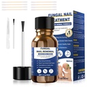 Plesňová liečba,Foot Fungus Liečba Extra sila,Fungus liečba nechtov, Toe Nechty Fungus Liečba na plesňové nechty žlté nechty liečba(1fl oz/30ml)