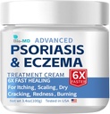 Bio-MD Psoriáza Ekzém Krém, Ekzém krém pre dospelých, Extra sila Control Recidence, Reliéve Symptóm Rezistentné, Účinné pre Seborrheic Dermatitis, Folliculitída Liečba