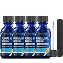 4ks Toenail Fungus Liečba, 25% kyselina undecylénová, klinčeková liečba pre nechty, Toe Nail Fungus liečba (2 FL OZ)